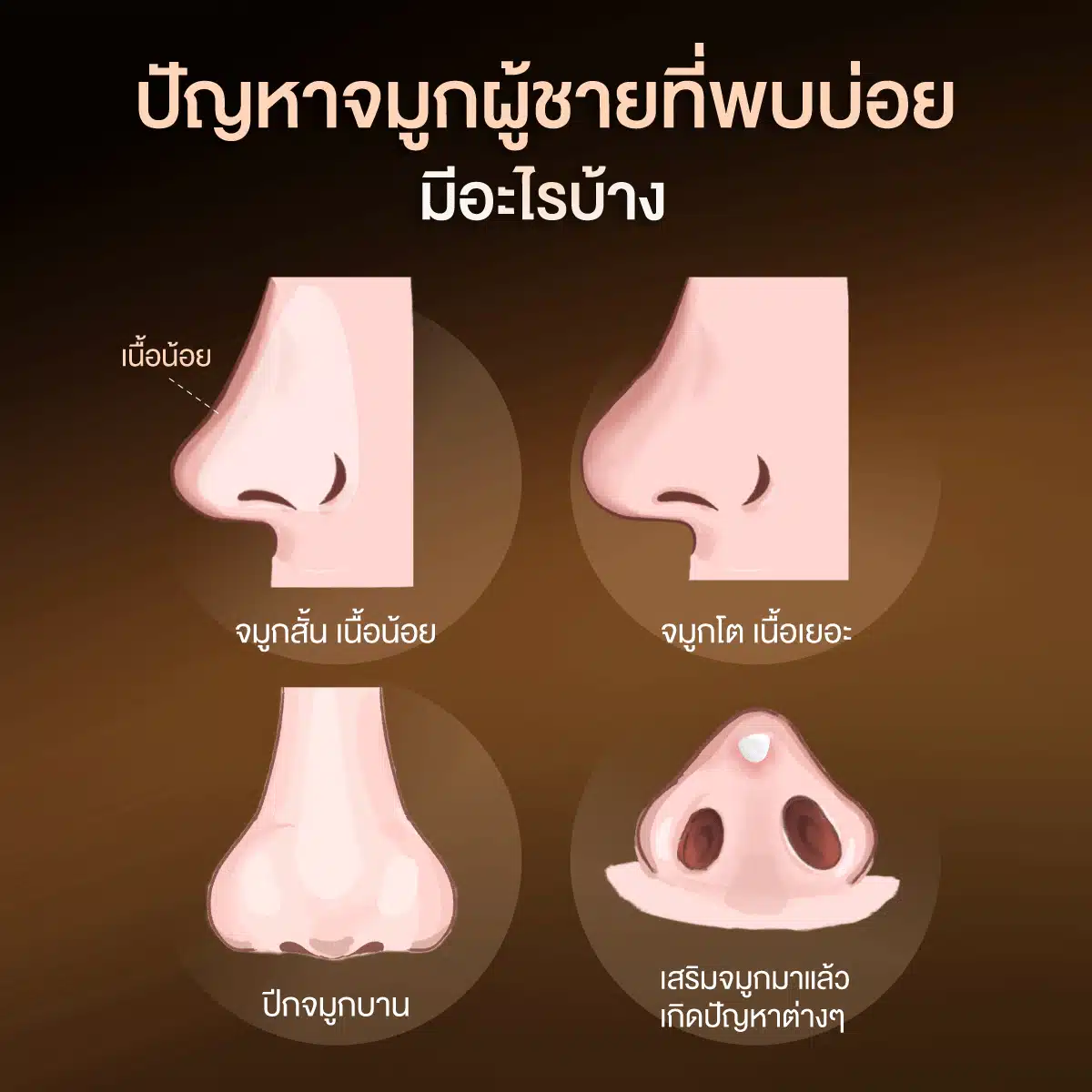 ปัญหาจมูกผู้ชายที่พบบ่อย