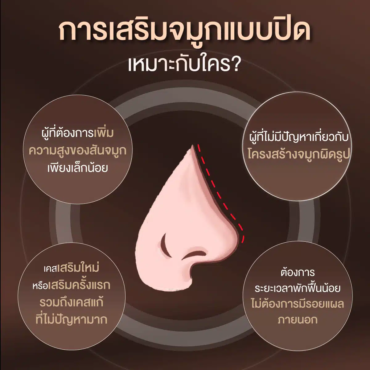 การเสริมจมูกแบบปิดเหมาะกับใคร 